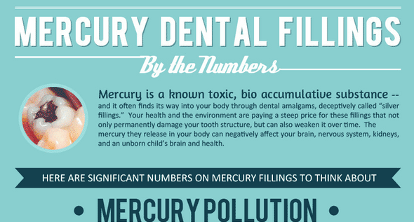 Mercury Dental Fillings-Infographics